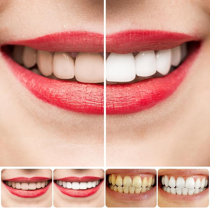 SP 4 Teeth Whitening Toothpaste