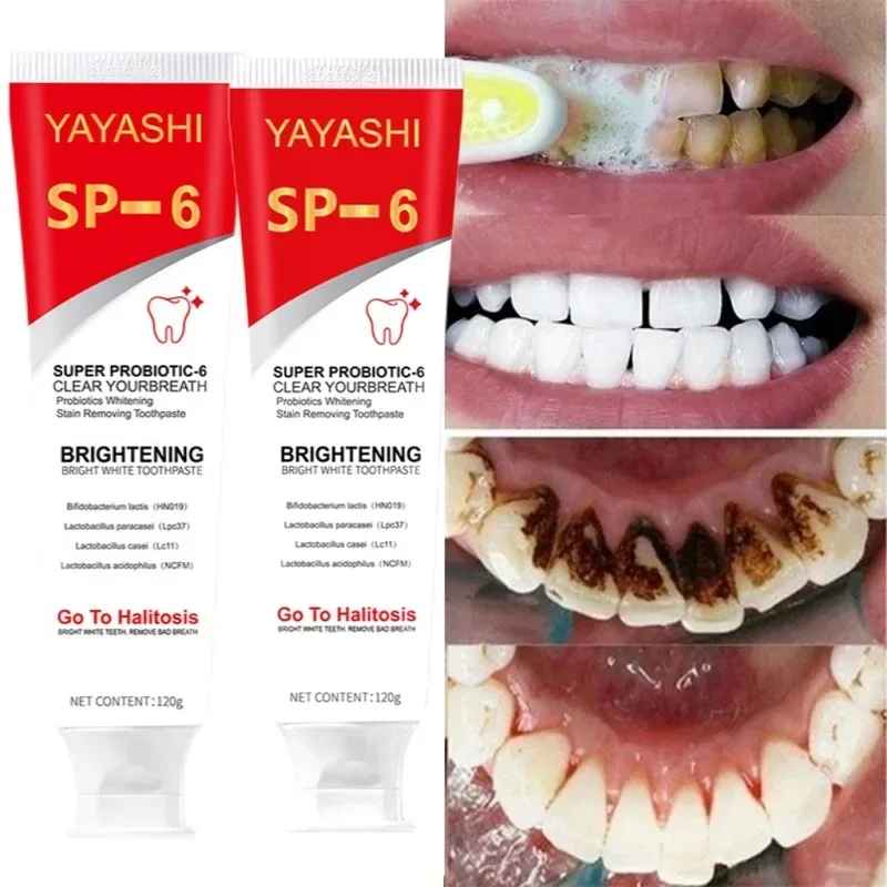 Probiotic Ultra Whitening Toothpaste