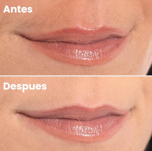 Face Hair Removal